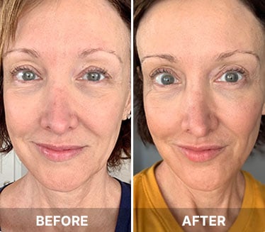 South Beach Skin Lab customer - Judith S.